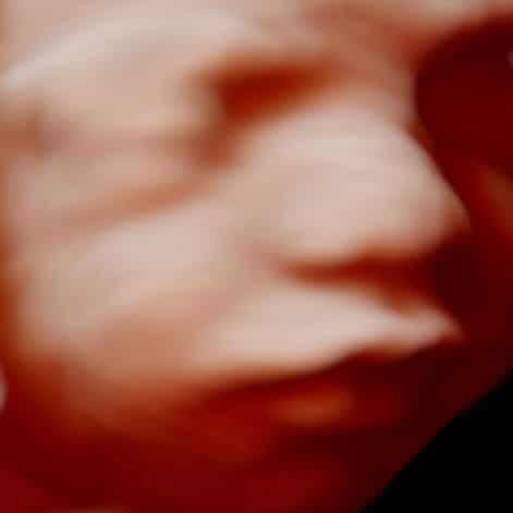 sas-krystal-3d-4d-pretecho-brabant